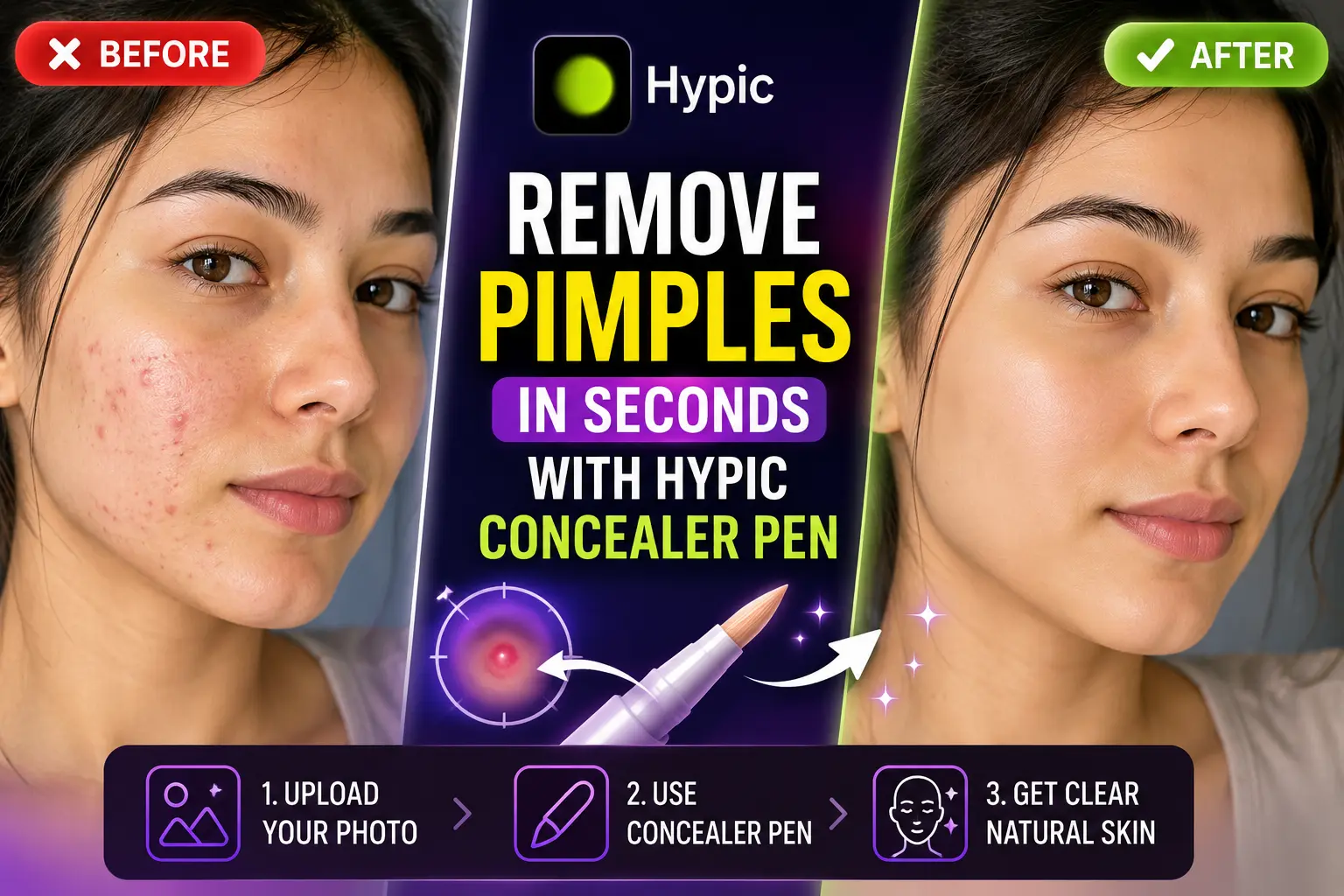 Hypic Concealer Pen removing pimples and acne marks using AI skin retouch tool in 2026